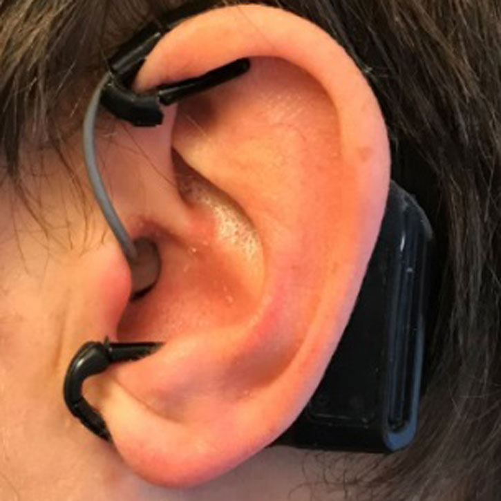 The device sits inside the outer ear canal