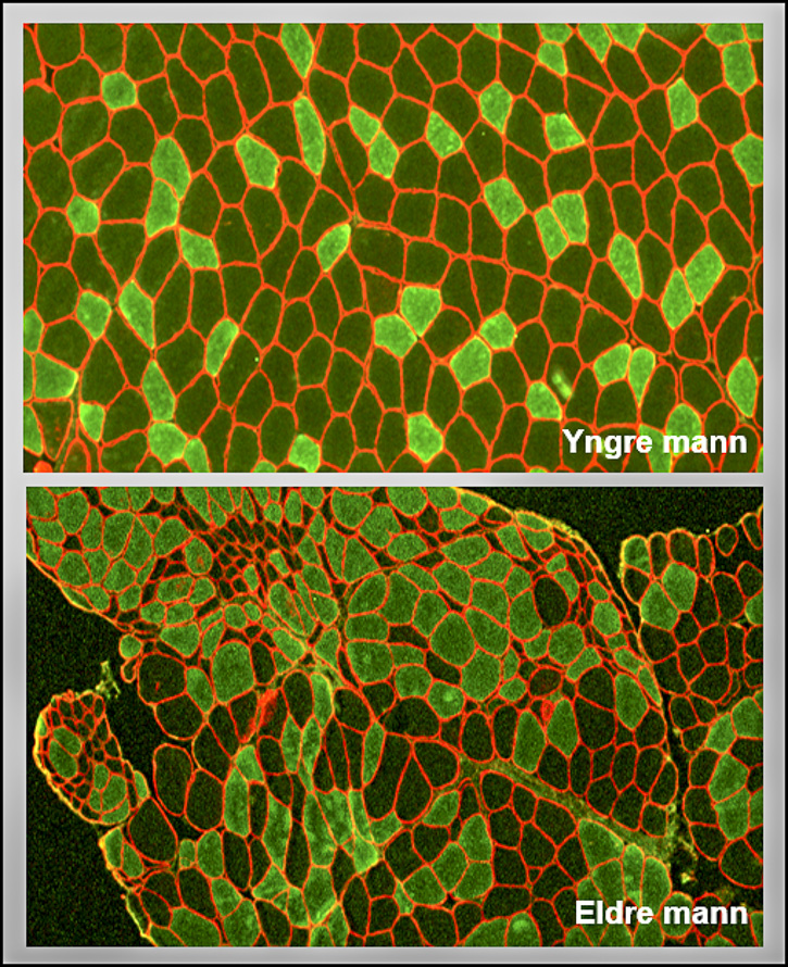 mucle tissue from a younger man is smooth and uniform compared to an older man
